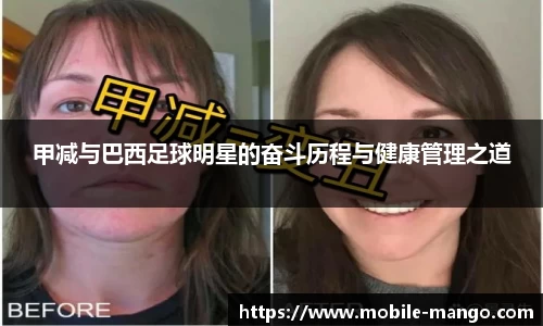 甲减与巴西足球明星的奋斗历程与健康管理之道